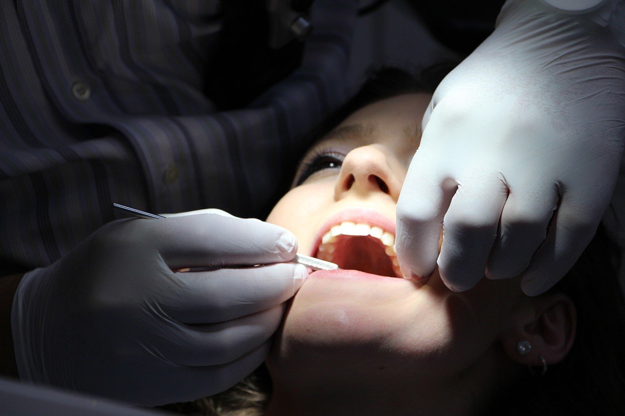 RISK OF SILVER OR METAL DENTAL FILLINGS, nutritionist los angeles, personal nutritionist | Shawn Phillips Personal Nutritionist Los Angeles