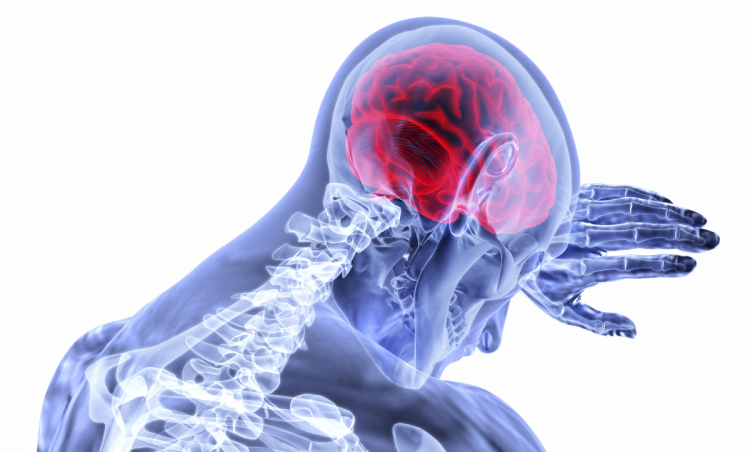 Brain health, brain health supplements