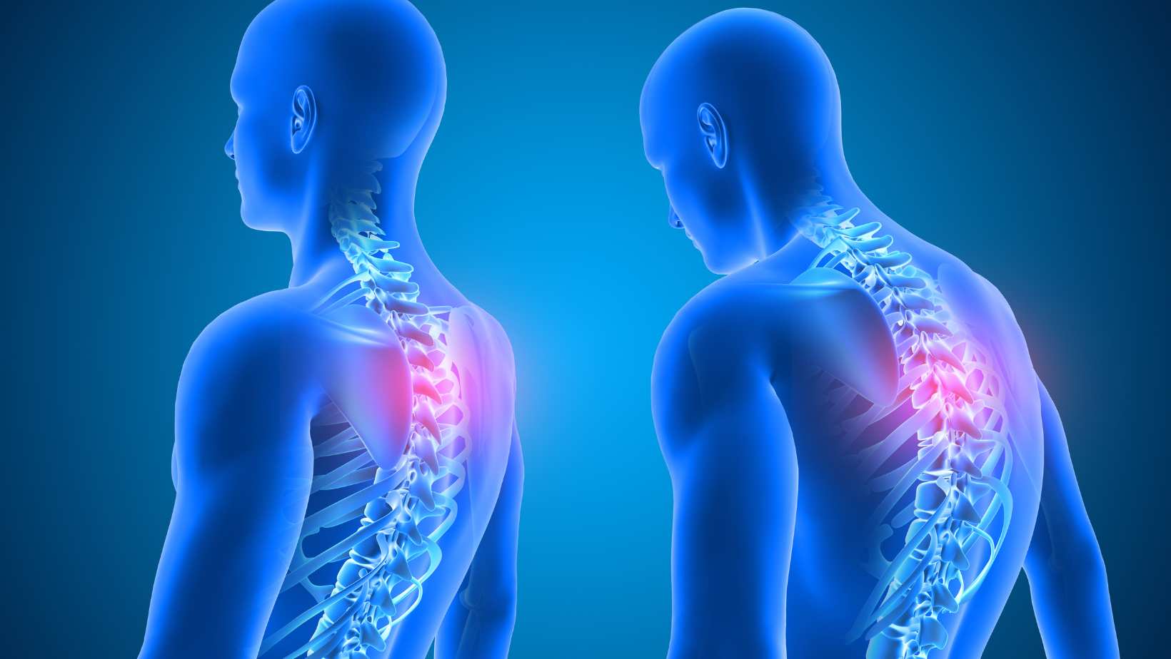 does bad posture cause chest pain