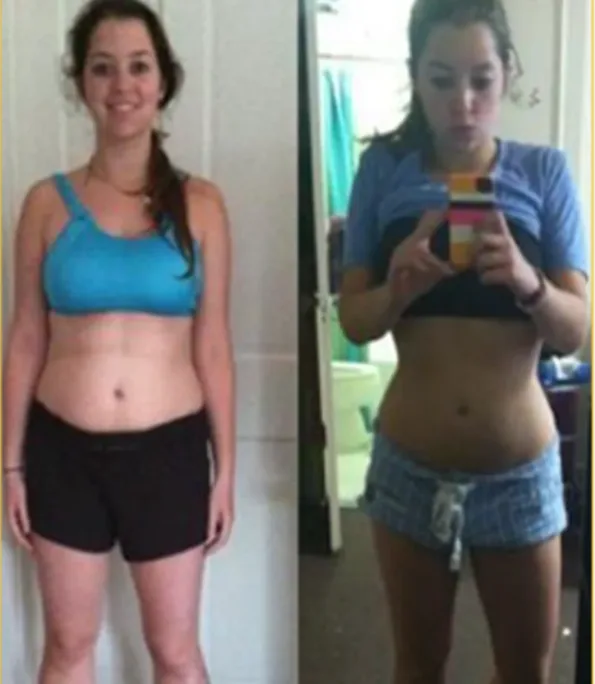 Woman before and after weight loss.
